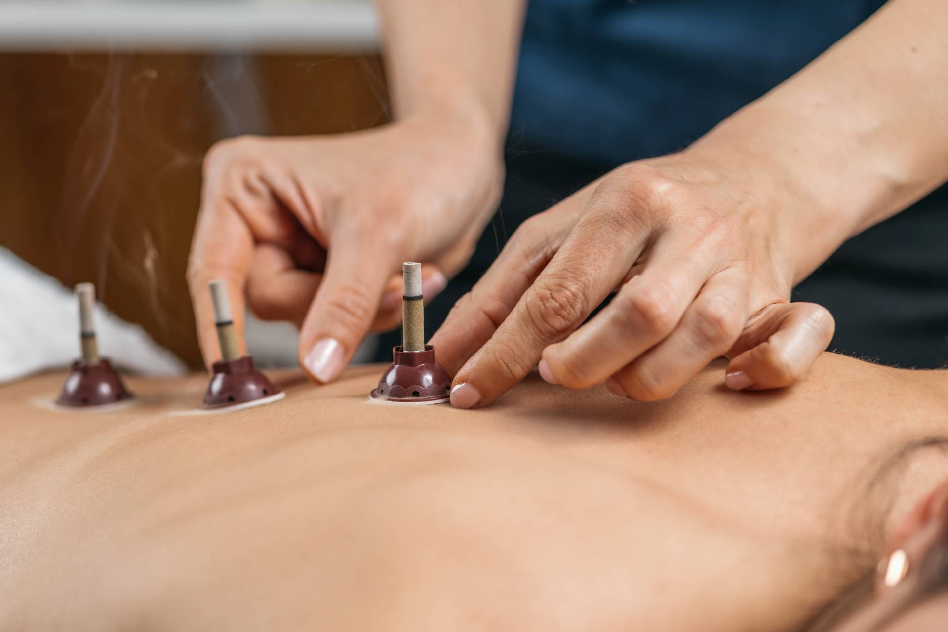 Moxibustion Therapy – Traditional Chinese Medicine